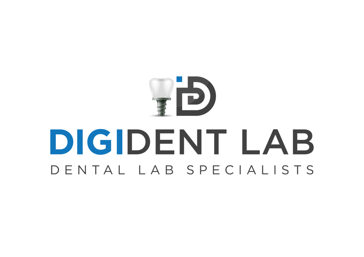 Aligners | Digident Lab